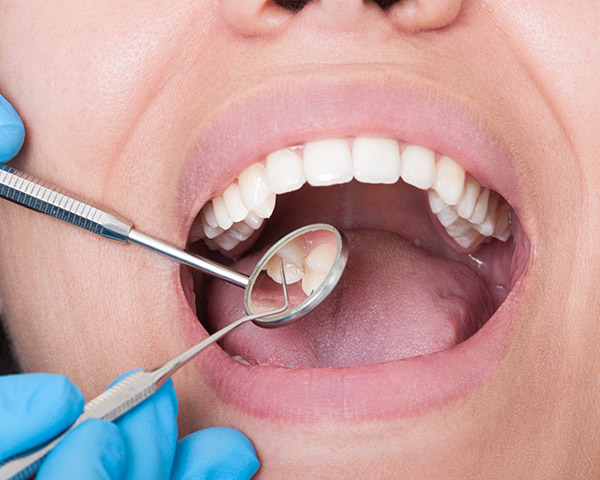 Dental Dental